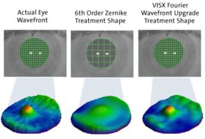 Fourier reconstruction provides the highest resolution of wavefront data.